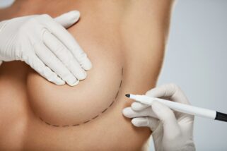 Cirugía mamaria: ¿qué vías de colocación de prótesis podemos usar?