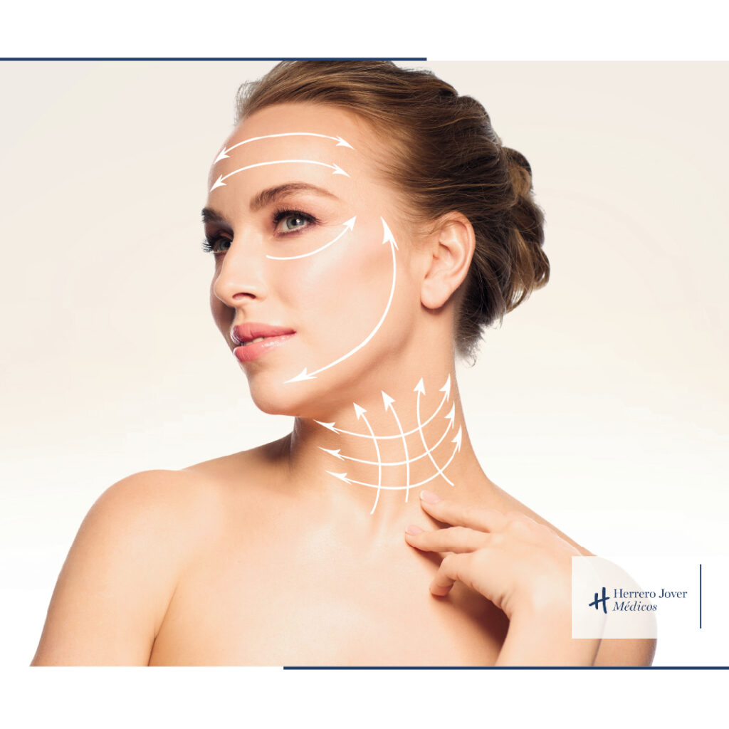 zonas del rostro para lifting facial