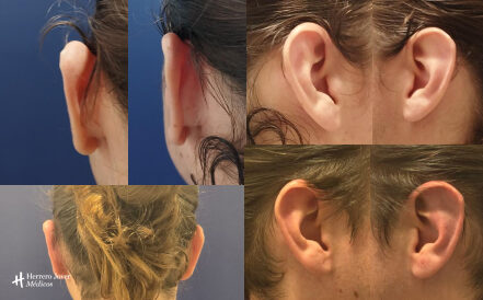 Hero E e1763935109884